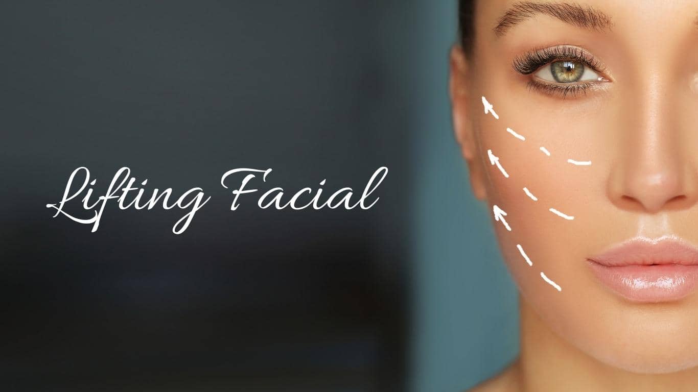 Cuáles son las principales ventajas de un lifting facial?